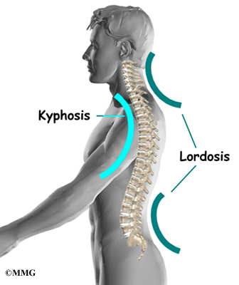 You are currently viewing Hyperkyphosis And How It Affects Our Body -Guest Post